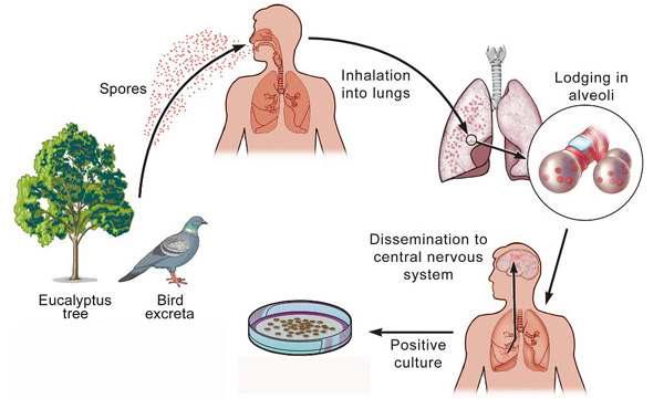 Cryptococcus neoformans의 감염 경로