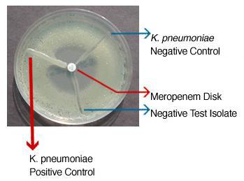 Carbapenemase 생성 분리주 검출을 위해 시행된 Modified hodge test.