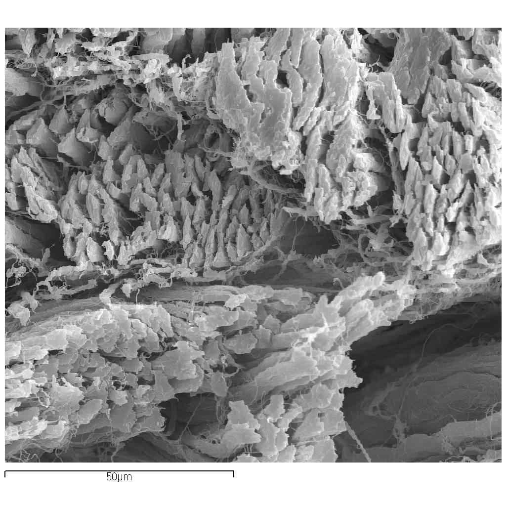 콜라겐 섬유 SEM 측정 사진