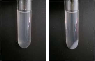 Dissolution of cellulose in NaOH/Urea system and regenerated cellulose from NaOH/Urea system