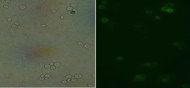 면역 현미경법을 통한 목적 단백질의 표면 발현 확인 (좌)- 위상차 현미경(control), (우)-형광 현미경 (Primary antibody,Anti-myc mouse IgG1; Secondary antibody, anti-mouse fluorescein