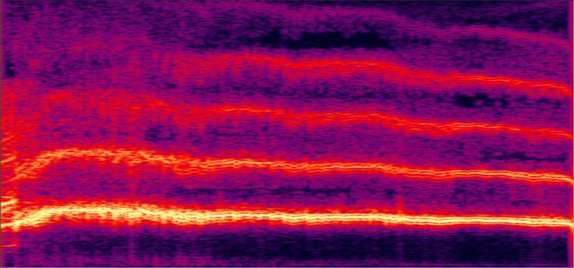 Spectrogram of abnormal voice