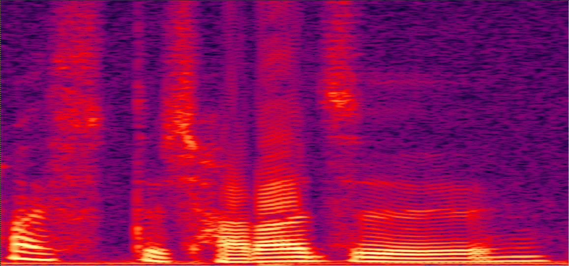 Spectrogram of normal voice