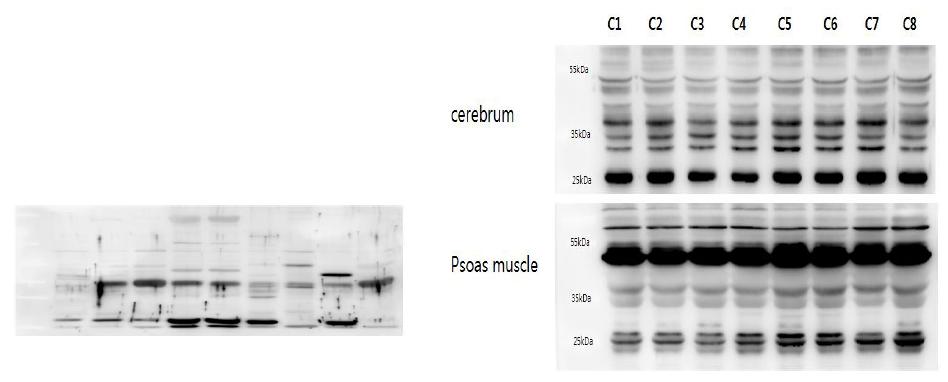 Individual variation of expression levels of TOP2B (left) and TBP (right) in rat organs