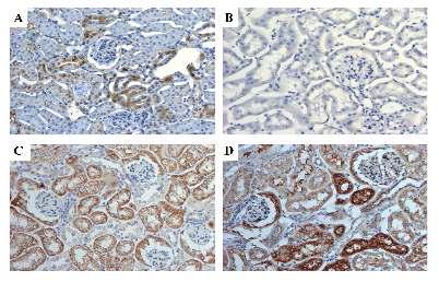 Fabry mouse kidney에서의 유전자치 료 및 효소치료 후의 α-galactosidase A에 대한 Immunohistochemistry (A) Wild type mouse (B) Fabry mouse (C) ERT-Fabry mouse (D) Gene therapy-Fabry mouse