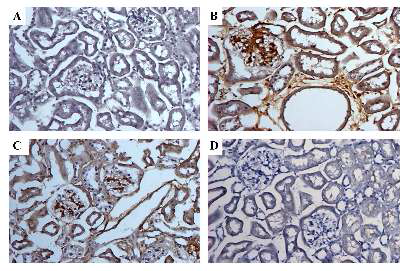 효소치료 후와 유전자치료 후의 Fabry mouse kidney에서의 Gb3 antibody (CD77) Immunohistochemistry (A) Wild type mouse (B) Fabry mouse (C) ERT-Fabry mouse (D) Gene therapy-Fabry mouse