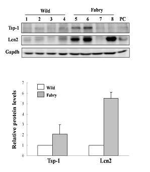 Fabry mouse kidney에서의 Lcn2와TSP-1의 발현 확인