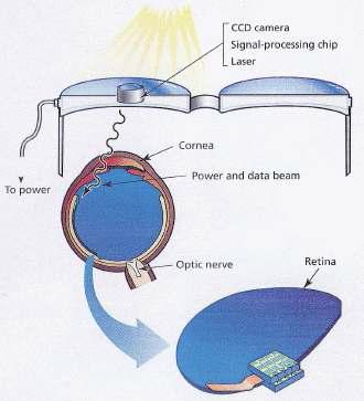 인공 망막의 수신부와 송신부모식도