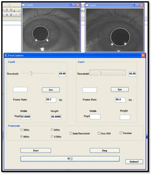 실시간 안구 영상 획들을 위한 프로그램