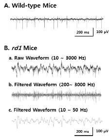 다채널전극(MEA)으로 기록한 wild-type 마우스(A)와 망막변성모델인 rd/rd (rd1) mice (B) 의 망막파형. 망막변성모델인 rd/rd 마우스의 망막파형은 망막신경절세포 스파이크 성분(B-b)과 약 10 Hz의 비정상적인 서파성분으로 (B-c) 분리된다.