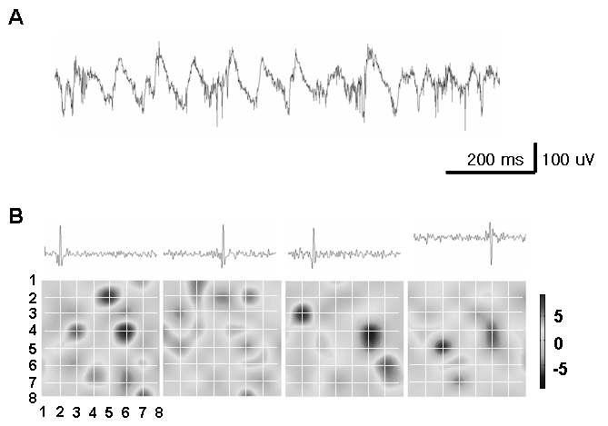 rd/rd 마우스 망막에서 기록한 망막파형을 ICA 로 분석.