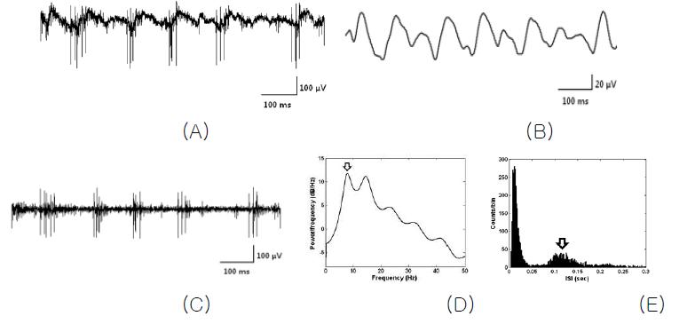 (A) 변성망막 신경절세포로부터 기록된 신경신호, (B) 기록된 신경신호에서 추출된 오실레이션 성분, (C) 변성망막의 자발적 스파이크 (spontaneous spike) 발생형태, (D) 오실레이션의 주파수 성분, (E) 스파이크의 inter-spike interval (ISI) histogram