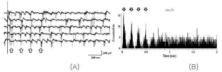 (A) 자극에 의해 유발되는 변성망막의 신경신호, (B) 자극에 의해 유발된 스파이크의 발화패턴을 확인할 수 있는 Post Stimulus Time Histogram (PSTH).