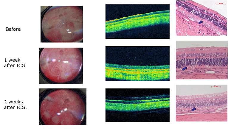 Sodium Iodate를 주입직전과 주입후 1주, 2주째안저소견(왼쪽), OCT 소견(가운데), 조직검사 소견(오른쪽)