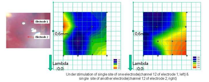 다채널동시기록시스템을 이용하여 측정한망막에 가해지는 전기자극의 세기변화에 따른 시피질전위 패턴 기록(P1 - N1 peak)