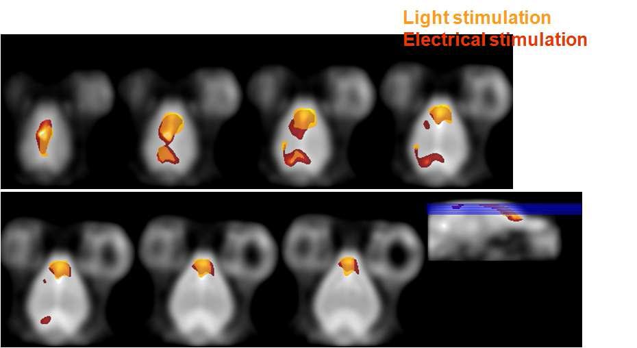빛(황색)과 전기 (적색) 자극에 의해 활성화 되는 대뇌 치질영역을 양전자방출 단층촬영으로 분석한결과. 두 자극에서 유사한 활성 영열을 보이며 전기 자극에서 보다 광범위한 후두위부분의 활성화를 보임.