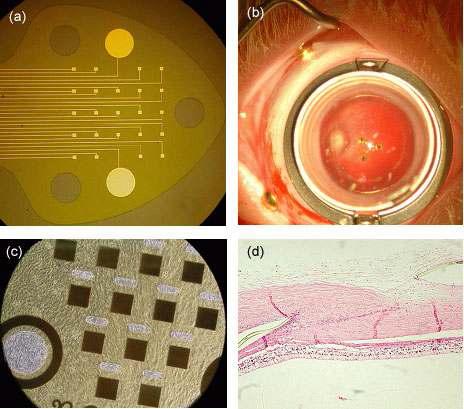 서울대에서 개발한 인공망막 (a) 자극용 전극 (b) 자극용 전극을 실험용 토끼망막에 삽입한 모습 (c) In-vitro 세포 배양 실험 (d) In-vivo 생체 적합성 실험