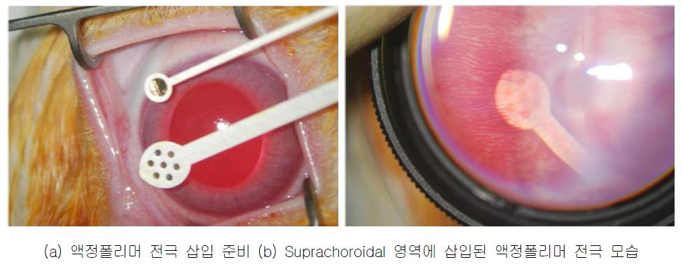 액정폴리머 망막 전극의 삽입 실험