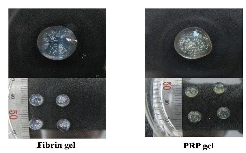 Fibrin gel과 PRP gel의 크기비교