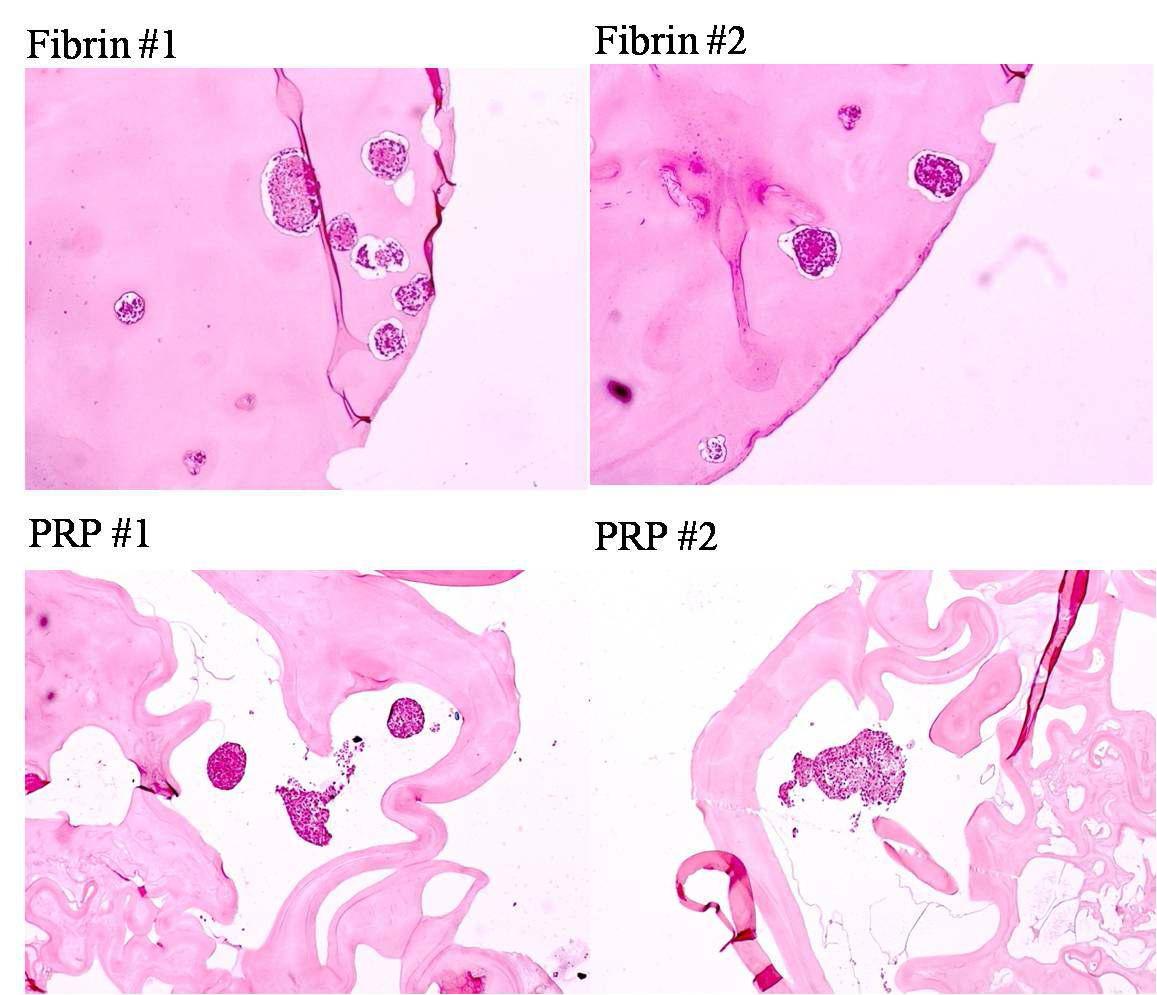 Fibrin gel과 PRP gel에서 췌도세포의 형태