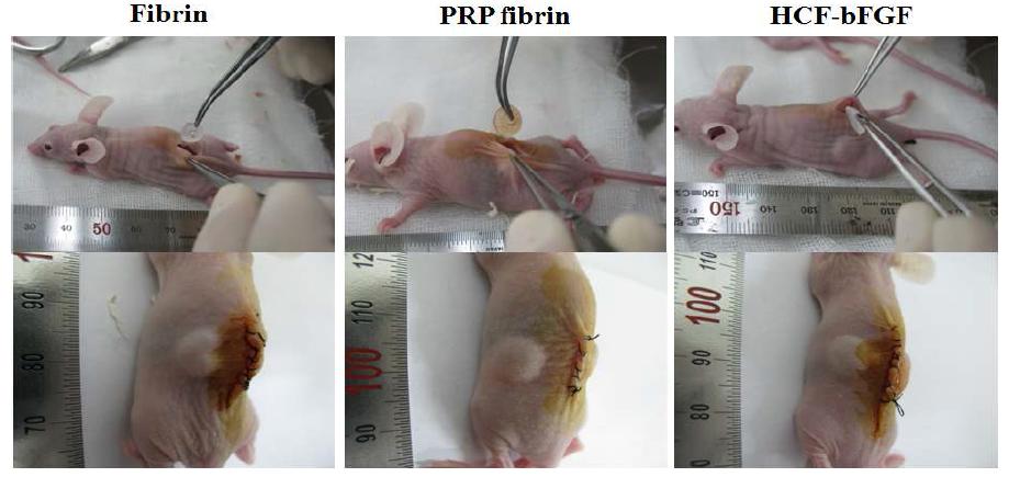 Fibrin gel과 PRP 및 bFGF를 포함한 fibrin gel을누드 마우스의 피하에 이식