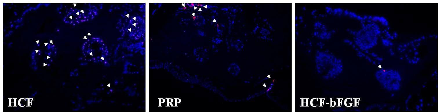 이식 3일 후, 적출한 gel을 TUNEL 염색을 통해 apoptosis 확인