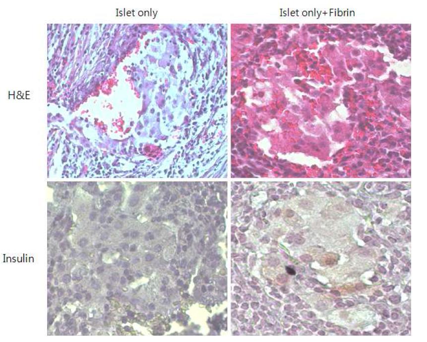 이식한 췌장 소도의 형태학적 분석과 인슐린 면역염색