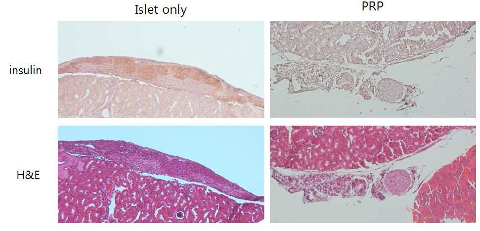 PRP gel 이식후 췌도세포의 H&E 염색