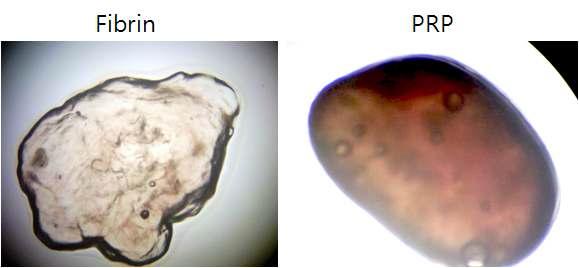 췌도세포를 감싼 Fibrin gel과 PRP gel