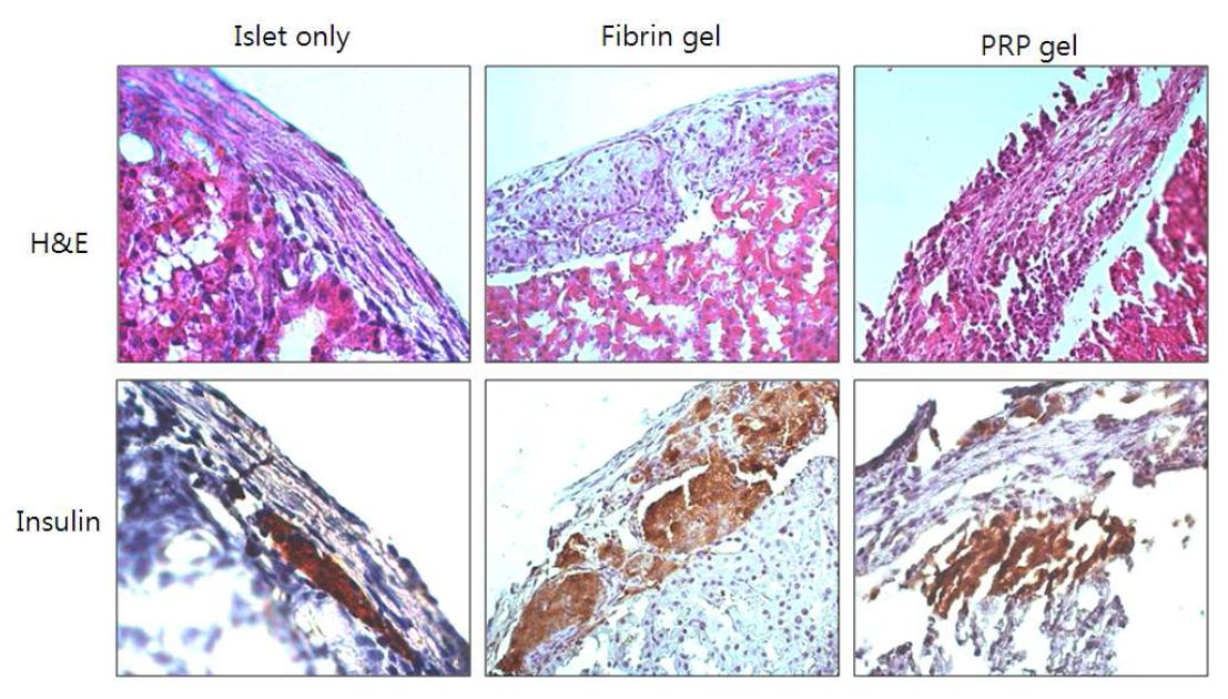 Fibrin 및 PRP gel 이식 후 췌도세포의 조직사진 결과