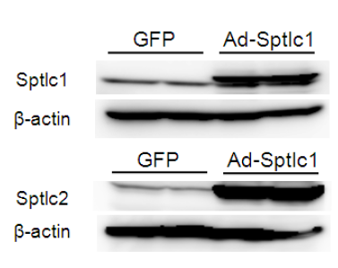 HepG2 간 세포주에서 Sptlc1과 Sptlc2 유전자 발현 검증. HepG2 세포에 Ad-GFP, Ad-Sptlc1, Ad-Sptlc2를 2 multiplicity of infection(MOI)로 24시간 동안 처리한 후 immunoblot으로 발현 변화를 측정함.