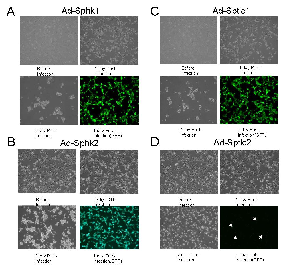 Sphk와 SPT의 아데노 바이러스의 구축 및 생산. Sphingosine kinase isozyme인Sphk1 (A)과 Sphk2 (B), Serine palmitoyltransferase subunit인 Sptlc1 (C) 과 Sptlc2 (D)의