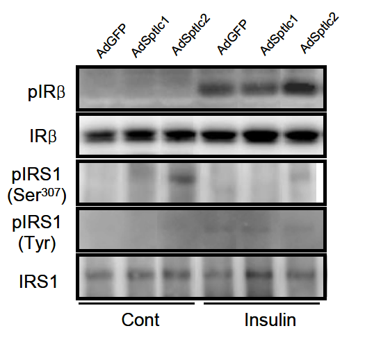 HepG2 간 세포에서 Sptlc1과 Sptlc2 과발현에 의한 IR과 IRS-1의 인산화 변화.