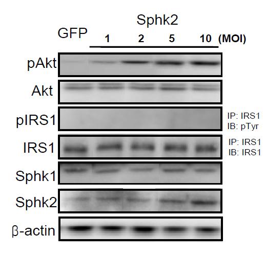 HepG2 간 세포에서 Sphk2 유전자 과발현 에 의한 pAKT 증가. HepG2 세포에 Ad-GFP, Ad- Sphk2를 다양한 농도로 16 시간 동안 처리하여 유전 자 과발현을 유도한 후 100 nM 인슐린을 10분간 처리 함. AKT와 GSK3β의 인산화 정도를 immunoblotting으 로 측정함.