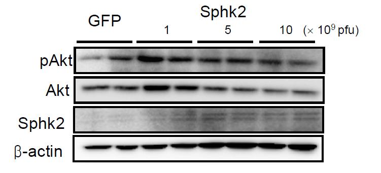 GFP-, Sphk2-아데노바이러스를 꼬리 정맥으로 주 입하고 7일 후 간조직에서 pAKT와 Sphk2의 단백질 발현 변화 응 immunoblot으로 확인하였음.