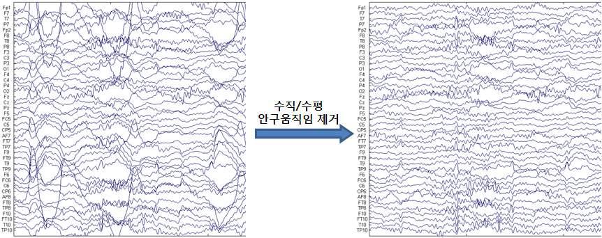 안구움직임성분이 제거되기 전 뇌파(좌), 안구움직임성분이 제거된 후 뇌파(우)