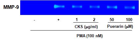 Effect of CKS and puerarin on MMP-9 secretion in RAW 264.7 cells. Conditioned media was collected and analyzed for the production of MMP-9. Zymography assays were performed, and the gelatinolytic activity of active MMP-9 (92 kDa) was visualized as clear bands against a blue background of stained gelatin.