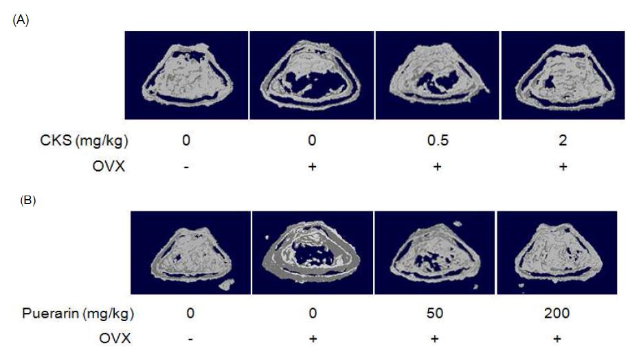 Effect of CKS or Puerarin on three-dimensional images were assessed by microcomputerized tomography ( CT). Three weeks after surgery, μ ovariectomized mice fed on CKS or Puerarin group was orally administered at a dose of 0.5 and 2 mg/kg or 50 and 200 mg/kg and control group was orally administered saline for 2 weeks.