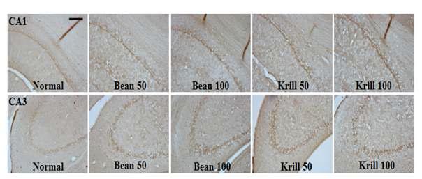 The representative photographs of BDNF ir neurons in the hippocampal CA1 and CA3