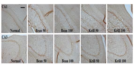 The representative photographs of IGF ir neurons in the hippocampal CA1 and CA3