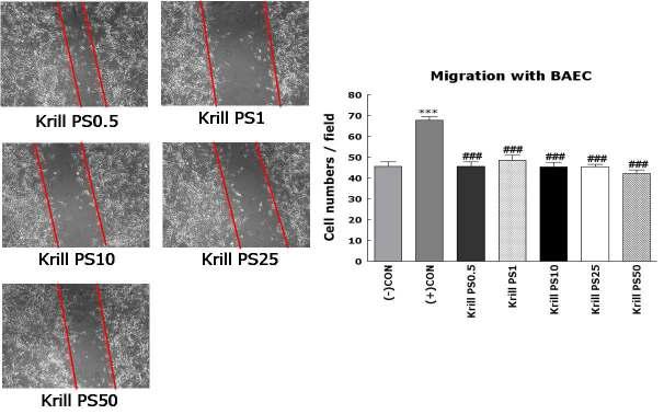 Effect of Krill PS on cellmigration in BAEC cells.