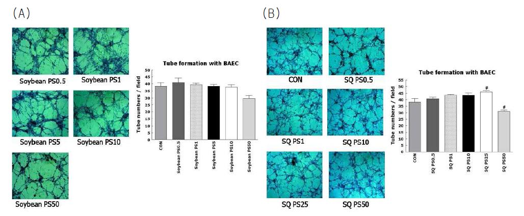 Effect of Soybean PS and Squid PS on tube formation in BAEC cells