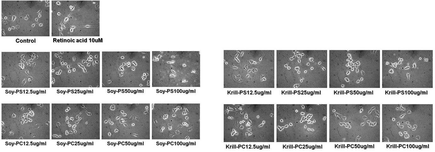 Representative photographs showing the neurite outgrowth on Neuro-2A cells cultured for 24 h following time of treatment of Soybean PS, Soybean PC, Krill PS and Krill PC.