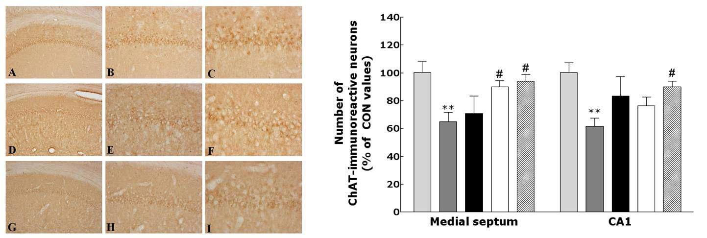 Representative photographs showing the distribution of choline acetyltransferase reactive cells in the hippocampus.