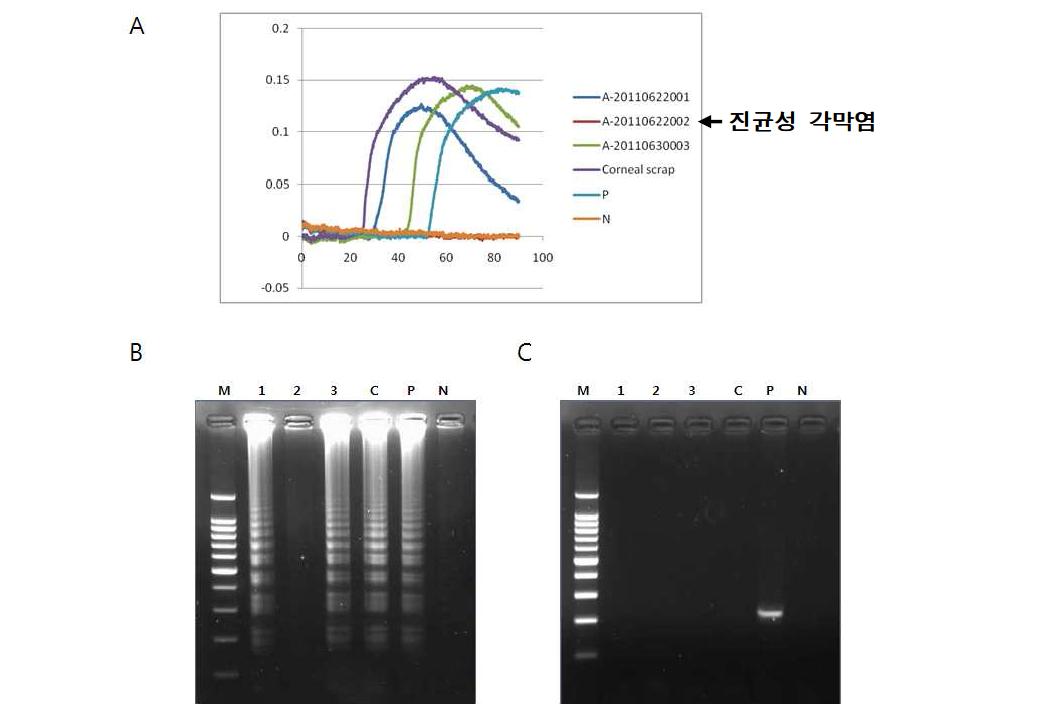 아메바성 각막염이 의심되는 다른 증례의 각막찰과 검체 및 진균성 각막염 환자의각막찰과검체에 대한 LAMP 반응 결과