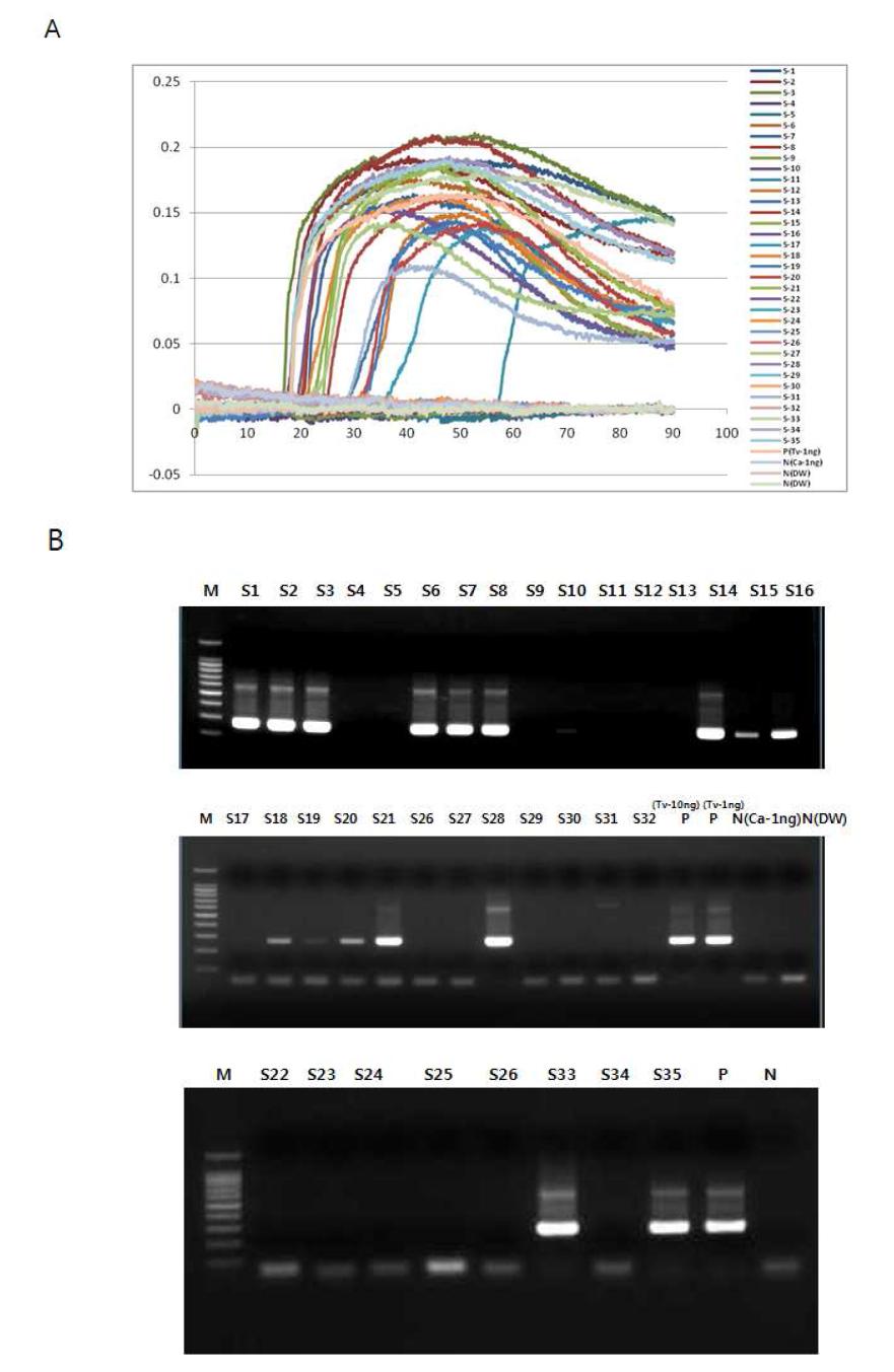 질염 환자의 질분비물 검체에서 분리한 DNA의 대한 (A) 실시간 LAMP 반응 결과 및 (B) PCR 결과의 비교.