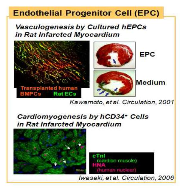 혈관내피 전구세포의 발견자인 일본의 아사하라그룹에 의한 급성 심근경색 치료연구