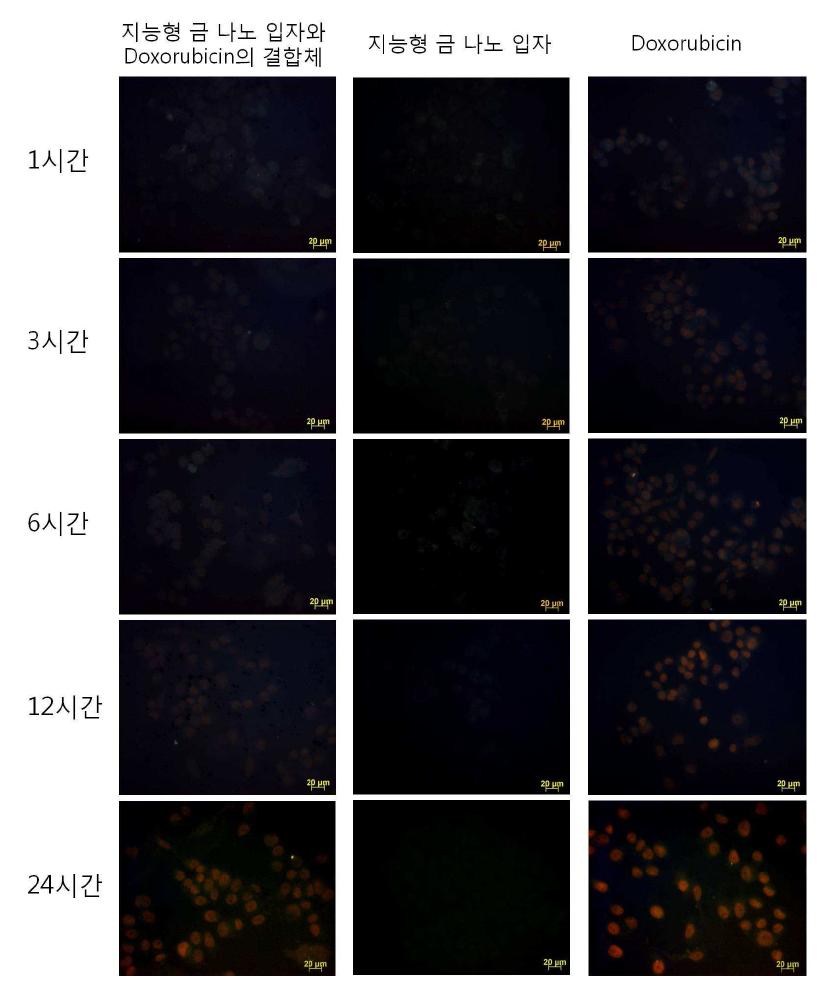 지능형 금 나노 입자와 Doxorubicin의 결합체를 함께 배양한 유방암 세포 실험군 (중간 열)과 지능형 금 나노 입자 (좌측 열) 및 doxorubicin (우측 열)을 함께 배양한 대조군의 시간에 따른 형광 현미경 사진