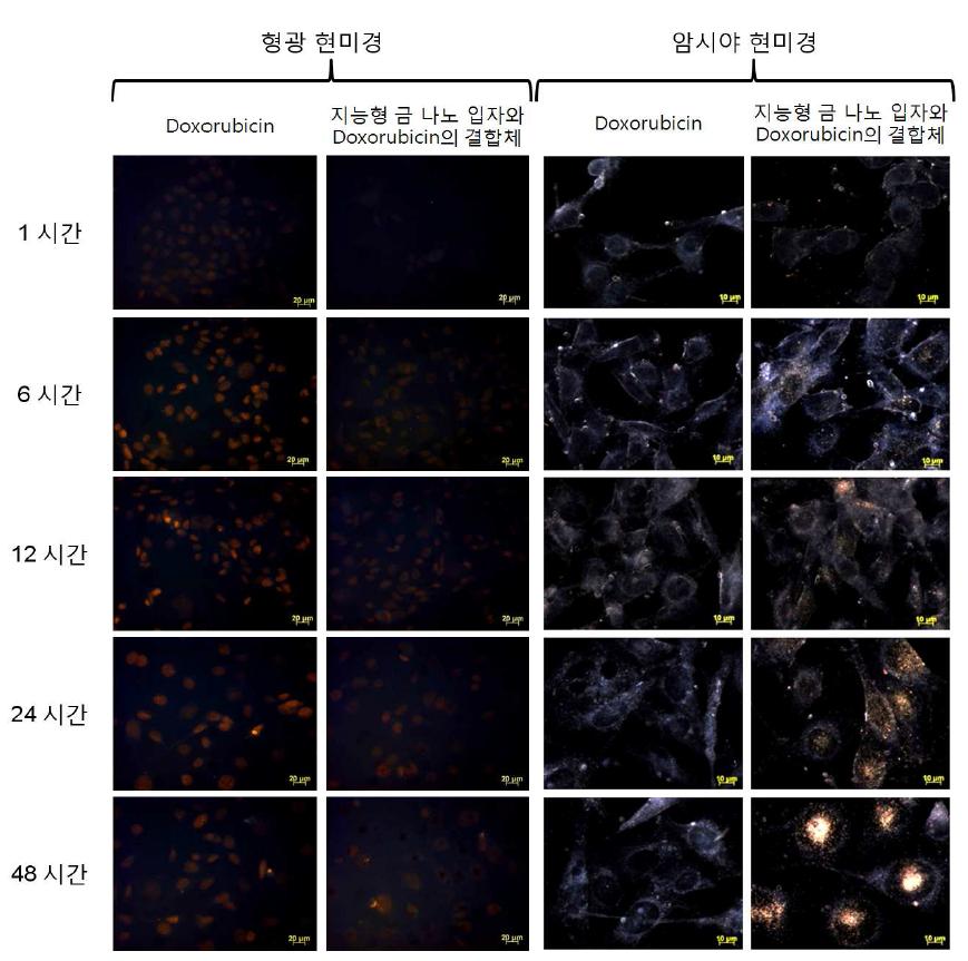 지능형 금 나노 입자와 Doxorubicin의 결합체를 함께 배양한 피부암 세포 실험군 (2, 4 번째 열)과 Doxorubicin (1, 3 번째 열)을 함께 배양한 대조군의 시간에 따른 형광 현미경 (1, 2 번째 열) 및 암시야 현미경 (3, 4 번째 열) 사진