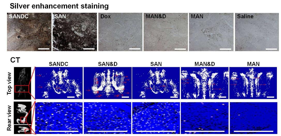 종양을 유도한 쥐에 지능형 금 나노 입자와 Dox 결합체 (SANDC), 지능형 금 나노 입자와 Dox 혼합체 (SAN 각 샘플 주입 후 24 시간 후에 컴퓨터 단층 촬영을 통해 쥐의 종양 부위를 관찰한 이미지